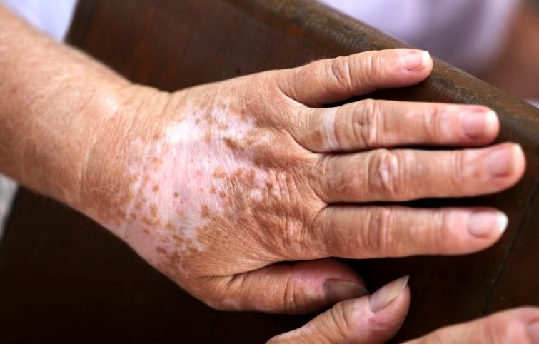 اخبار سلامت