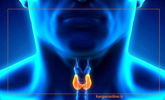 درمان تیروئید