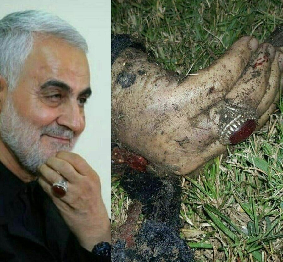 روایتی دردناک از وضعیت پیکر سردار سلیمانی