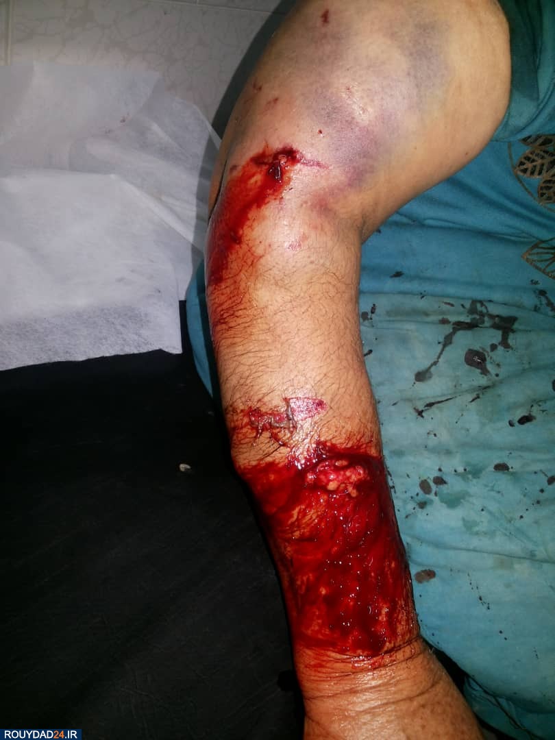 سگ ولگرد ۶ نفر را تیکه پاره کرد / در گردکوه رخ داد