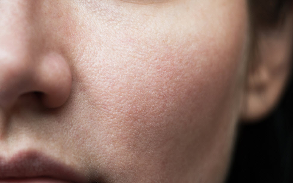 باز شدن منافذ پوست