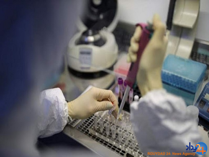 آزمایش کرونارایگان است