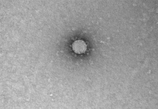 تصاویری جدید از ویروس کرونا