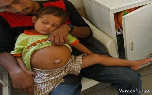 ماجرای حاملگی دختر ۳ ساله چه بود؟ +عکس