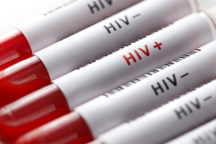 اعلام جدیدترین آمار ایدز در کشور