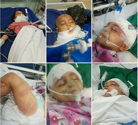 شکنجه وحشیانه دختربچه مرندی +تصاویر تکاندهنده شکنجه وحشیانه دختربچه مرندی +تصاویر تکاندهنده