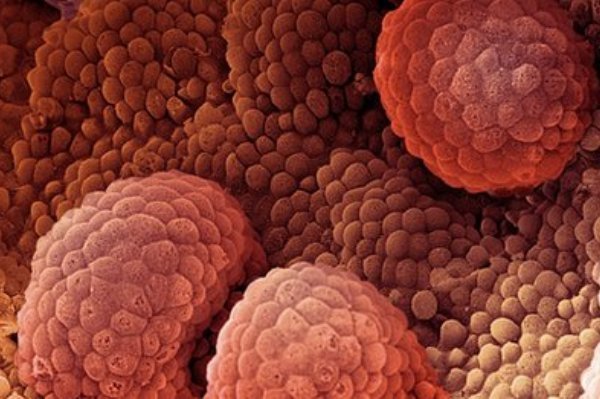 ۱۰ بیماری که می‌توانند کمتر از ۲۴ ساعت موجب مرگ شوند