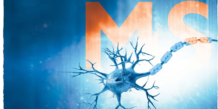 اما و اگرهای ازدواج بیماران مبتلا به «ام اس»