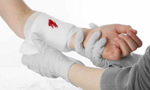 کمک&zwnj;های اولیه در مواقع خونریزی و قطع عضو
