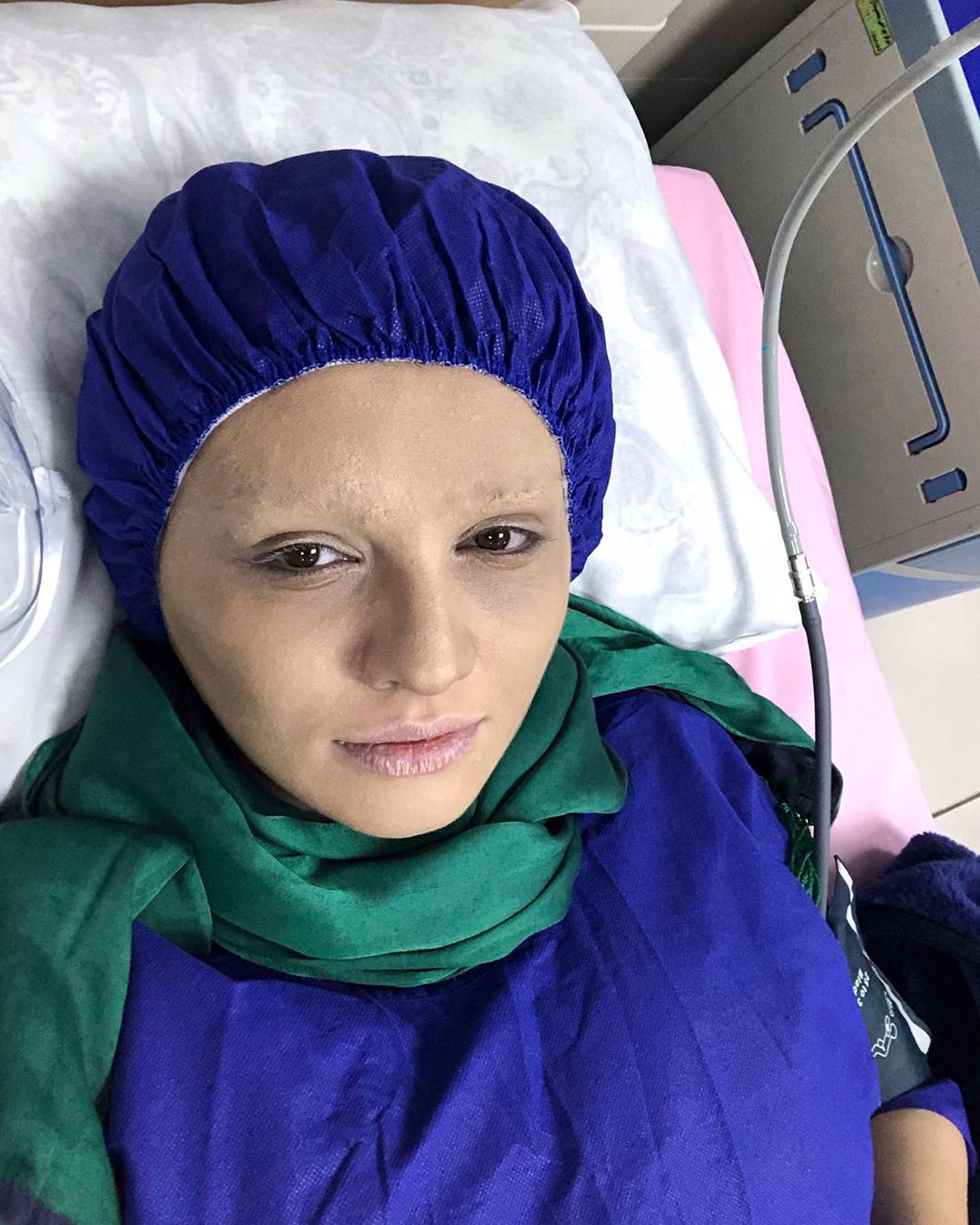 سیما خضرآبادی شبیه بیماران مبتلا به سرطان