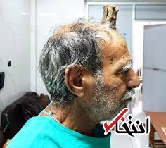 خارج کردن شاخ شیطان از سر مرد هندی! +عکس