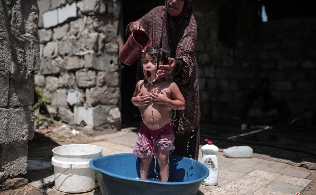 حمام یک کودک در غزه