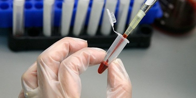 توضیحات وزارت بهداشت درباره ابتلای اهالی یک روستا به ایدز/ ابتلای اهالی یکی از روستا‌ها به ایدز کذب است