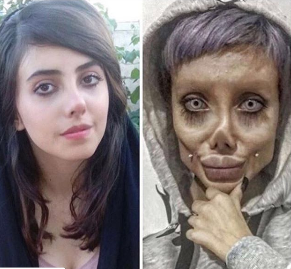 سحر تبر، نماد فروپاشی آرمان‌های انقلاب زیر تیغ عمل‌های جراحی زیبایی