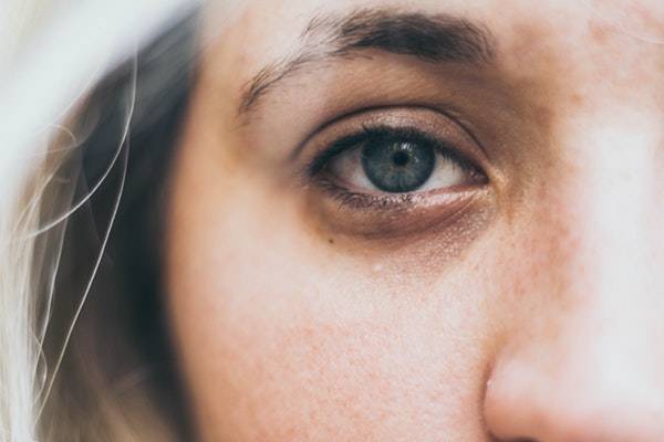 اخبار سلامت/ چگونه سیاهی و کبودی دور چشم را از بین ببریم؟ اخبار سلامت/ چگونه سیاهی و کبودی دور چشم را از بین ببریم؟