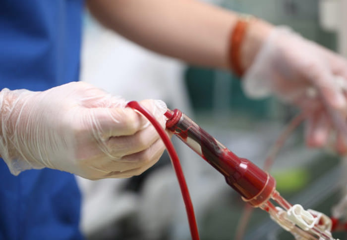 تزریق خون اشتباه به یک بیمار در کرج