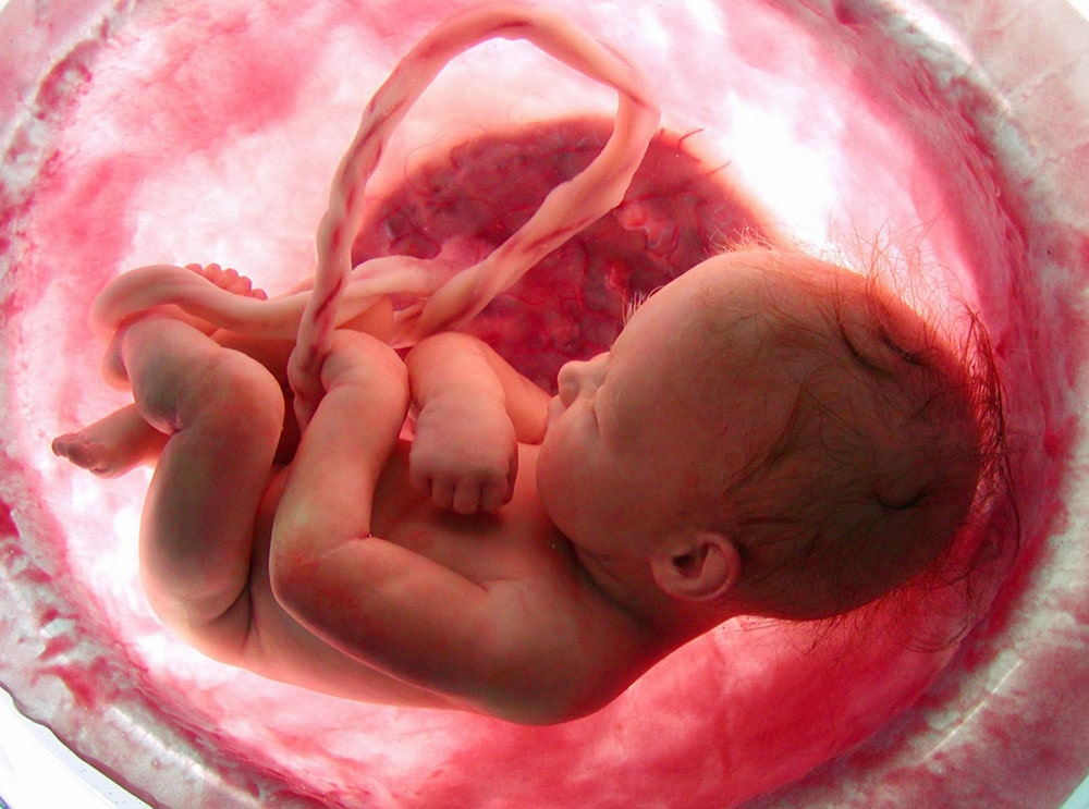 سقط غیرایمن از عوامل مهم مرگ زنان در دنیا