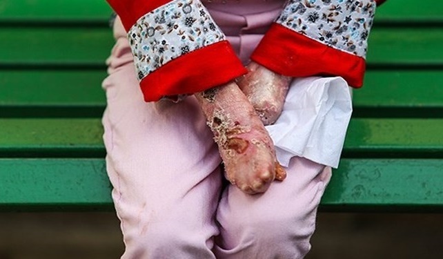 اجازه نمی‌دهیم تحریم بیماران «ای بی» را دچار مشکل کند