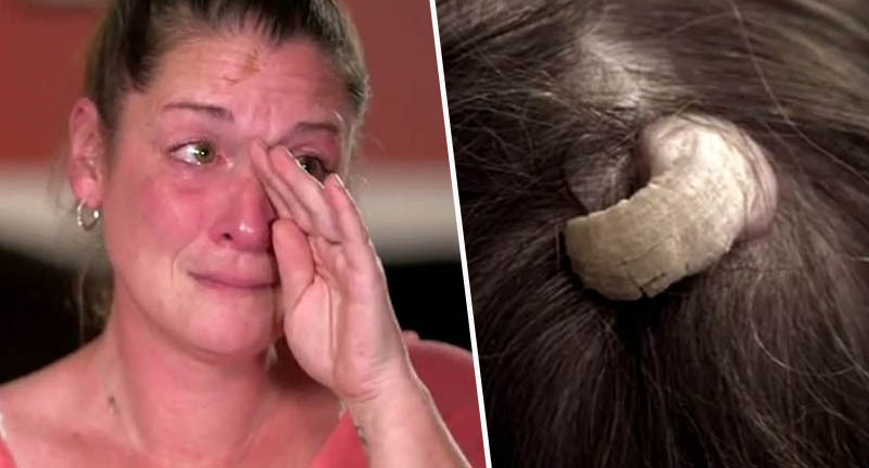 زن شاخدار، متخصصان را شگفتزده کرد! زن شاخدار، متخصصان را شگفتزده کرد!