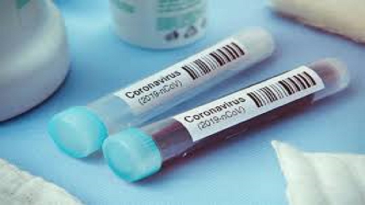 مقدمات تولید پادتن کرونا در کشور فراهم شد