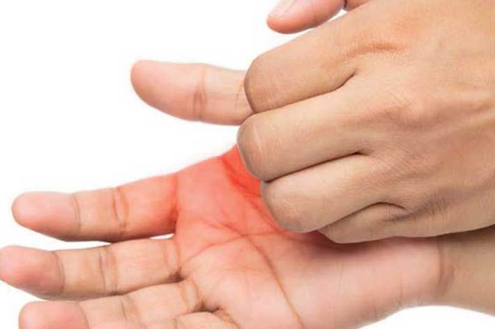  دلایل خارش کف دست‌