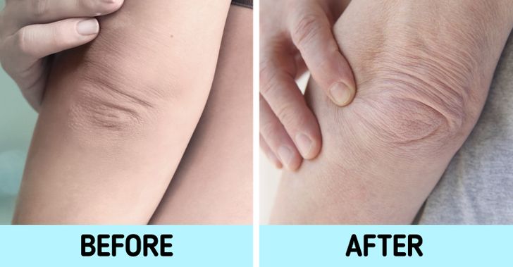 اخبار سلامت