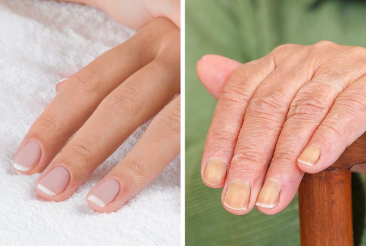 ۷ عضو بدن که سن واقعی‌تان را برملا می‌کنند