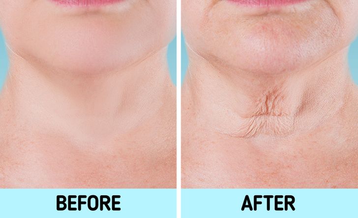 ۷ عضو بدن که سن واقعی‌تان را برملا می‌کنند