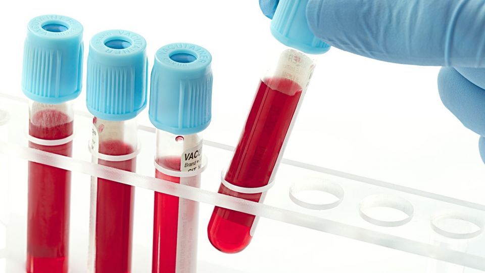 اخبار سلامت اخبار سلامت