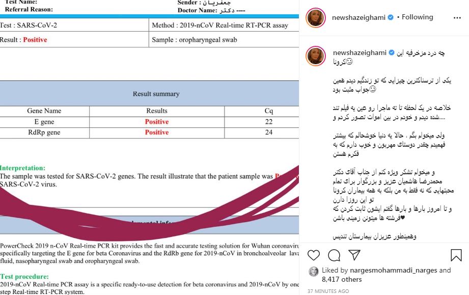 یک بازیگر دیگر به کرونا مبتلا شد +عکس یک بازیگر دیگر به کرونا مبتلا شد +عکس