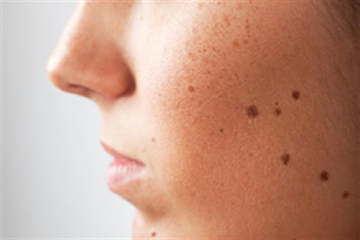 پوست و زیبایی