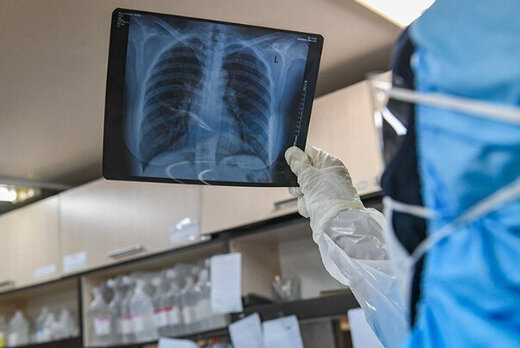 راه های انتقال ویروس کرونا