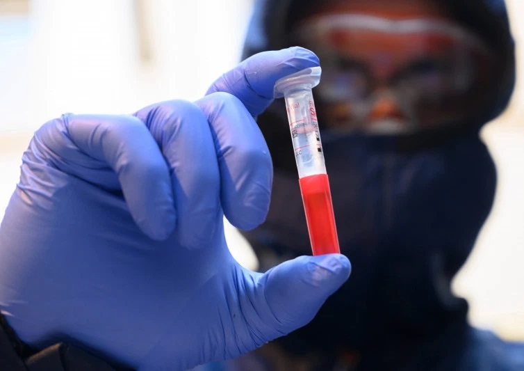 ویروس کرونا