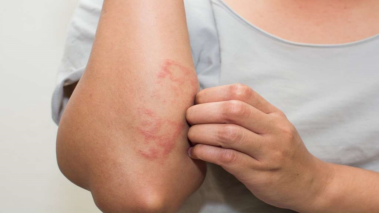 شیوع ویروس کرونا