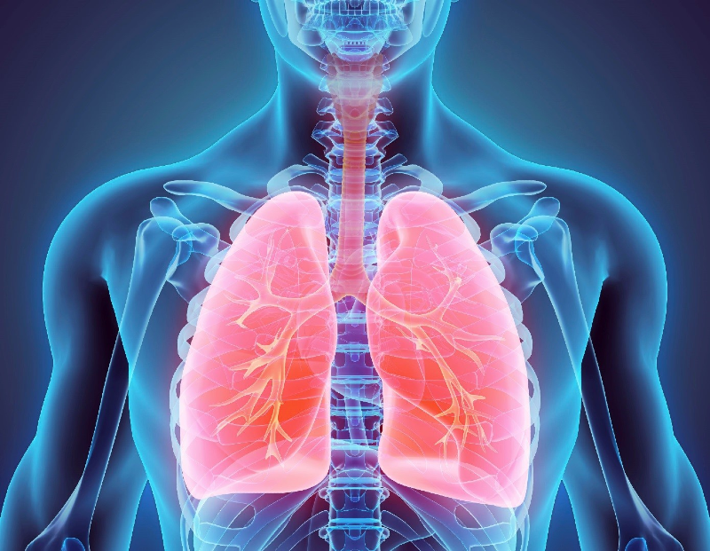  بیماری ریوی 