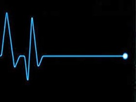 شایعترین علل مرگ در مردان شایعترین علل مرگ در مردان