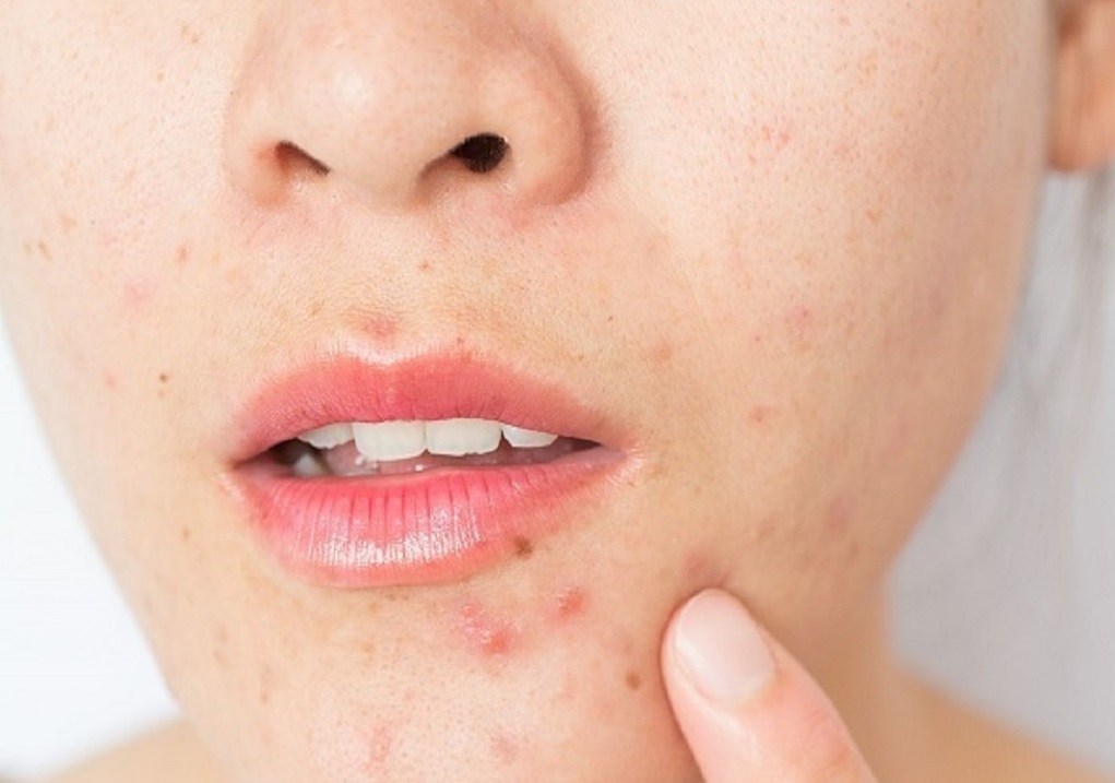 پوست و زیبایی