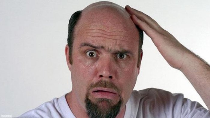 دلایل ریزش مو