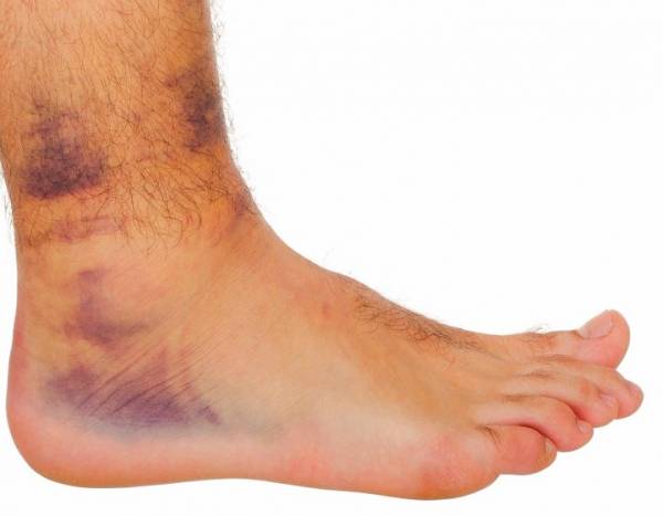 ویروس کرونا ویروس کرونا