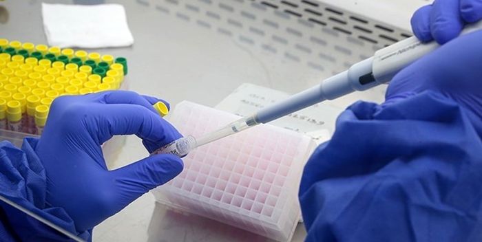 تست ویروس کرونا