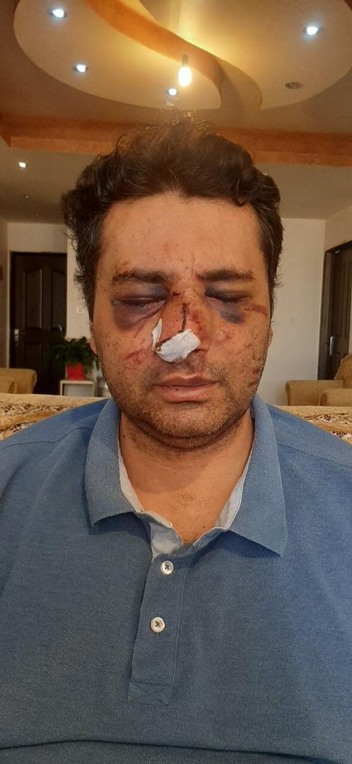 ضرب و شتم متخصص بیهوشی