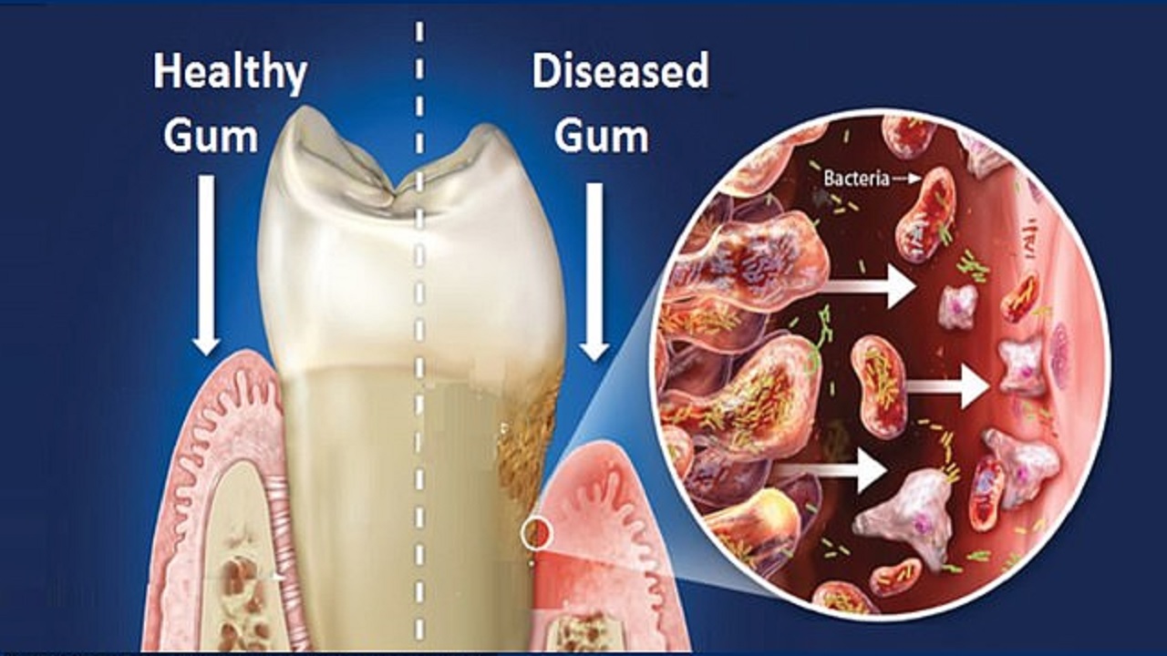 علت اصلی ابتلا به کرونا