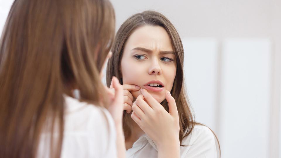 درمان آکنه و جوش