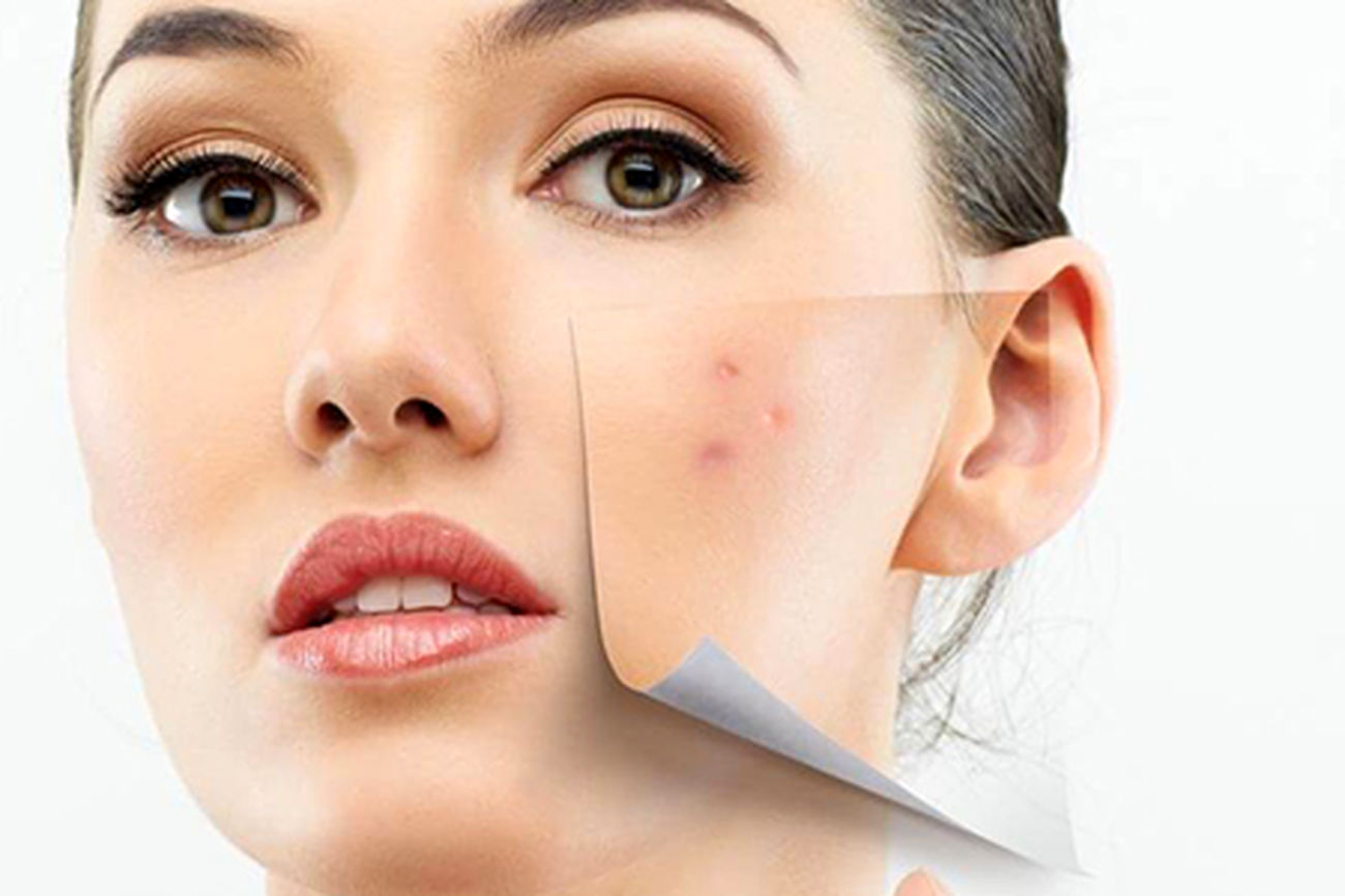 پوست و زیبایی