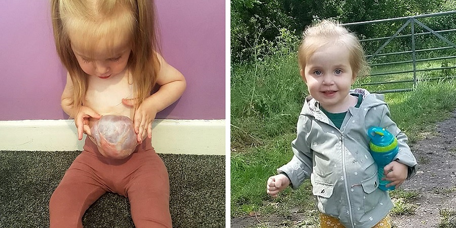 مشکل مادرزادی دختر بچه انگلیسی