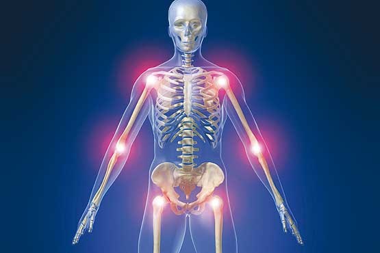 درد ناحیه مفاصل