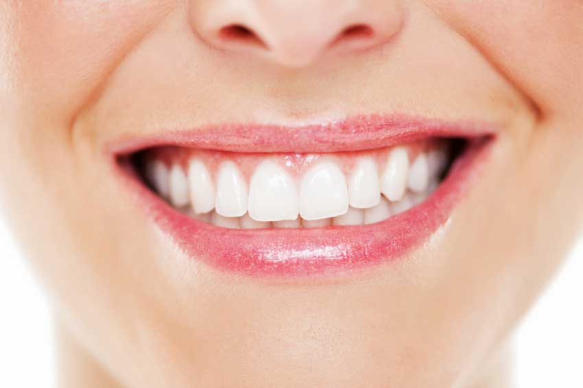 روش سفید کردن دندان ها