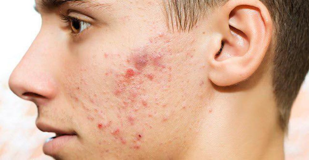 پوست و زیبایی