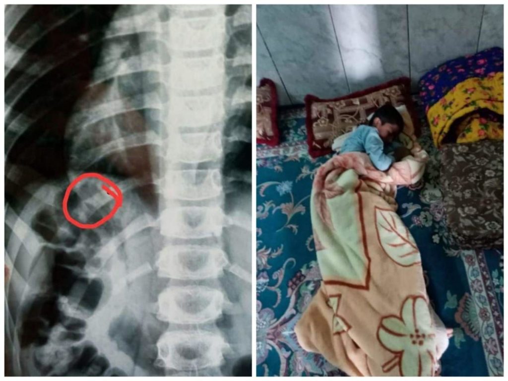 داستان موسی/ روایتی از ضرب و شتم کودک چابهاری توسط معلم