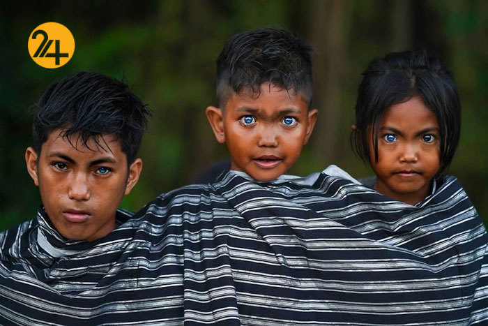 بیماری خاص خالق چشمان خاص